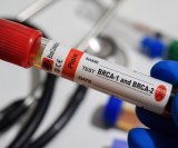 BRCA testiranje