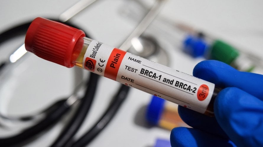 BRCA testiranje
