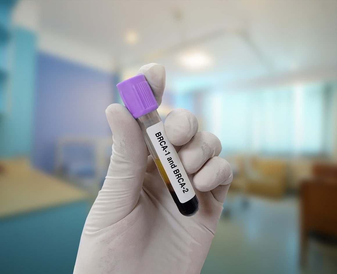 BRCA testiranje - HZZO