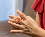 Bol u zglobovima i oticanje ključni su pokazatelji ozbiljnosti reumatoidnog artritisa