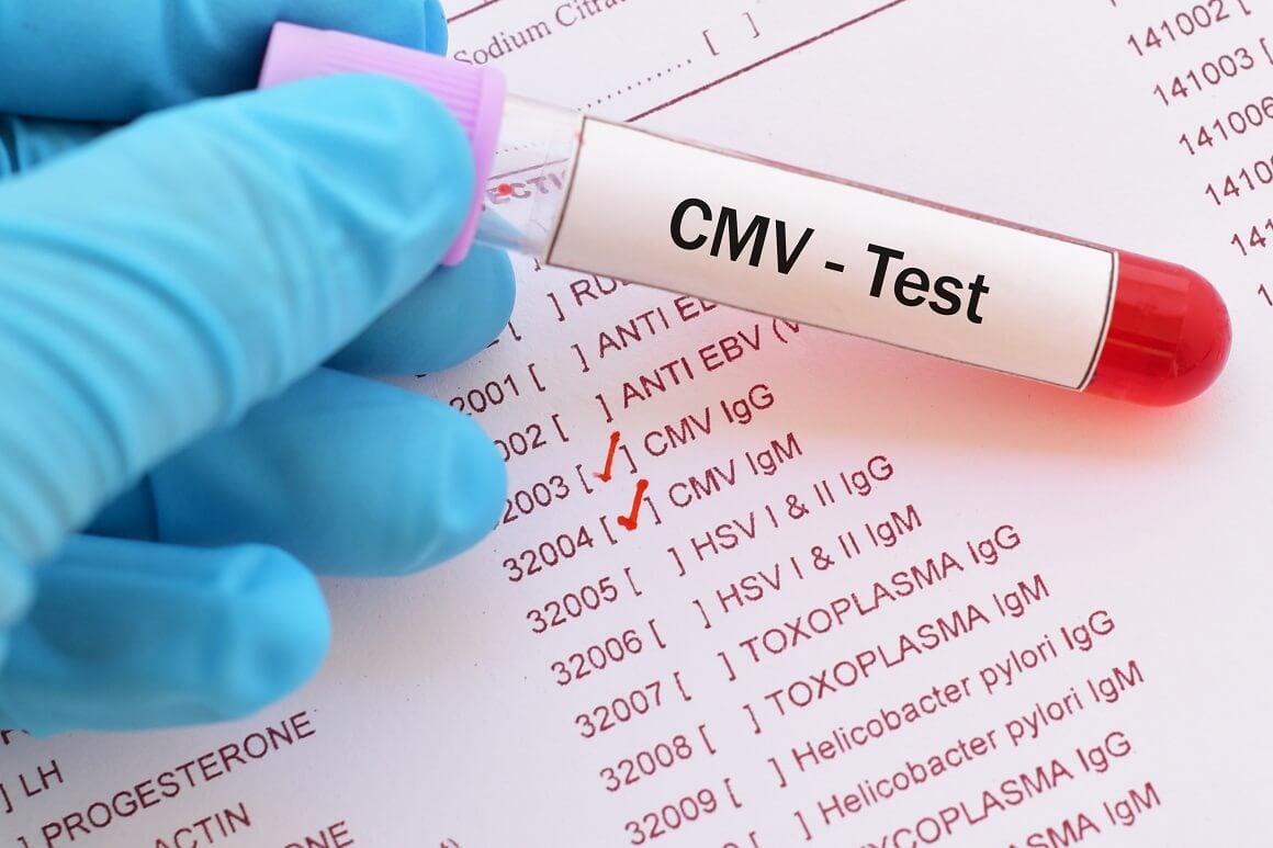 Kod osoba s oslabljenim imunološkim sustavom CMV može izazvati ozbiljnije probleme