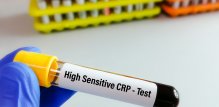 CRP, dobiven jednostavnim testom krvi, služi kao opći marker upale u cijelom tijelu