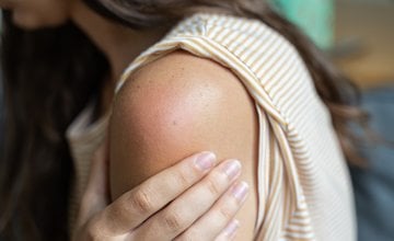 Nuspojave cijepljenja