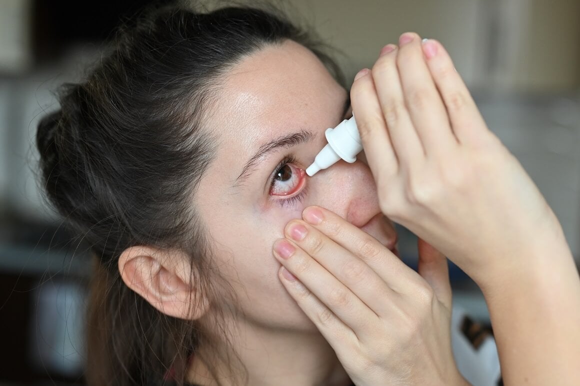 Suho oko - liječenje