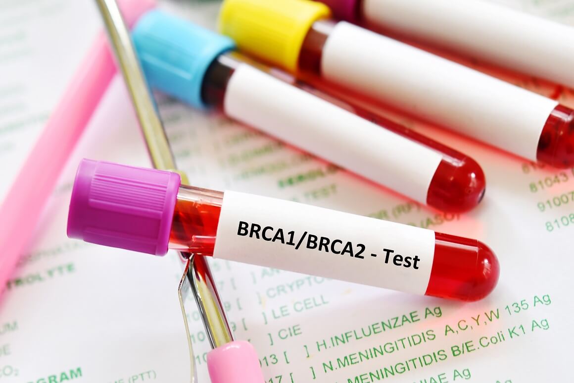 Većina žena u Hrvatskoj nedovoljno je informirana o genetičkim testiranjima, uključujući one za BRCA1 i BRCA2 mutacije