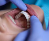jednostavno skeniranje usta tijekom redovitih posjeta može obaviti drugo medicinsko osoblje