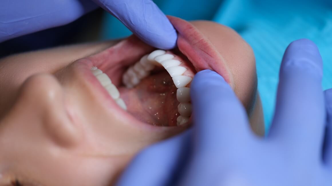 jednostavno skeniranje usta tijekom redovitih posjeta može obaviti drugo medicinsko osoblje