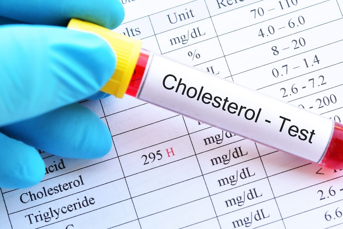 povišeni LDL kolesterol u ranoj dobi povećava rizik od koronarne bolesti srca