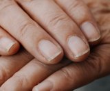 Prirodno liječenje upaljene zanoktice