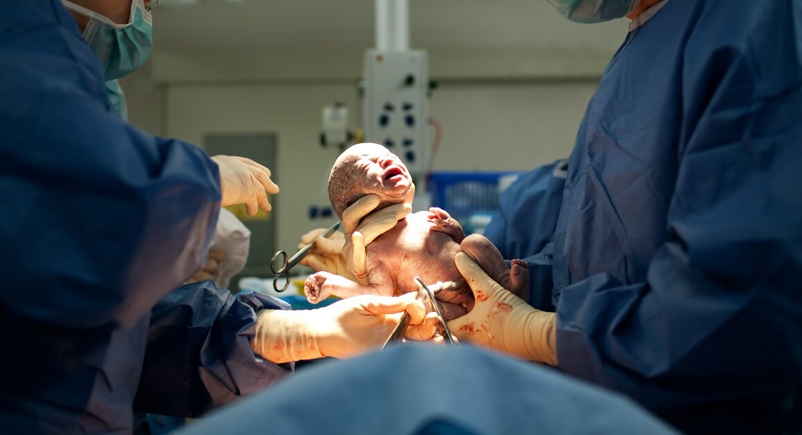 8 % beba rođenih u SAD-u ima nisku porođajnu težinu, dok je oko 10 % nedonoščadi