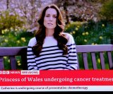 Kate Middleton prima preventivnu kemoterapiju