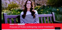 Kate Middleton prima preventivnu kemoterapiju