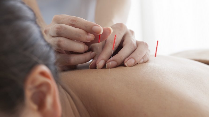 akupunktura pomaže kod reumatoidnog artritisa