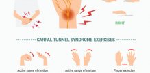 sindrom karpalnog tunela