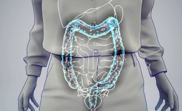 Zdravlje debelog crijeva