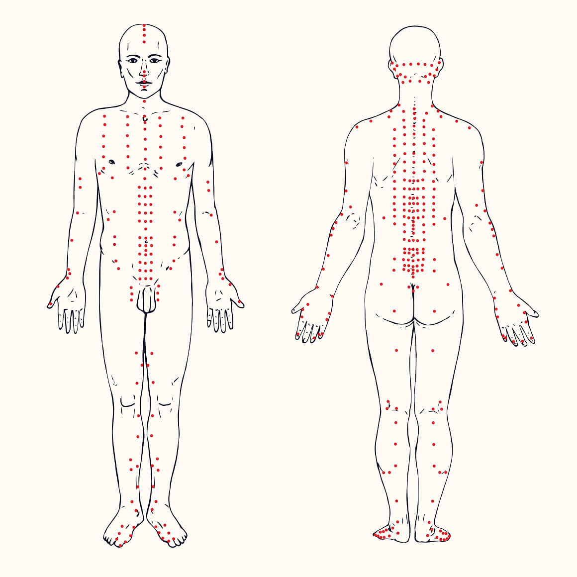 akupunkturne točke na tijelu