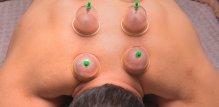 Cupping terapija - nuspojave