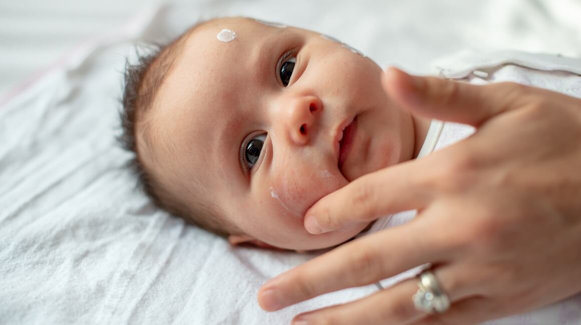Najbolja krema za atopijski dermatitis kod beba