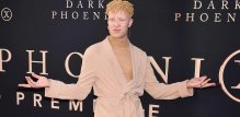 Poznati albino ljudi