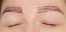 Život s alopecijom Evo kako prikriti gubitak dlaka