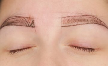 Život s alopecijom Evo kako prikriti gubitak dlaka