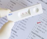 hcv test