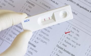 hcv test