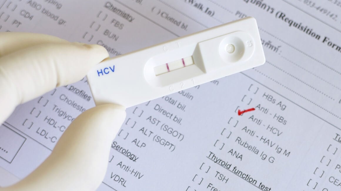 hcv test