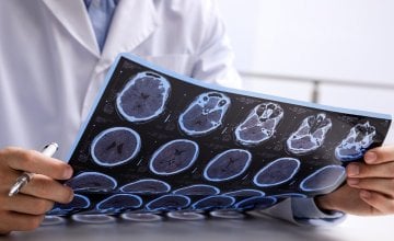 Ova prehrambena navika može uzrokovati multiplu sklerozu