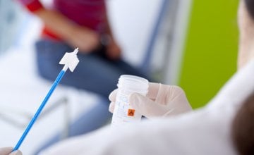 HPV tipovi 16 i 18 odgovorni su za većinu karcinoma povezanih s HPV-om