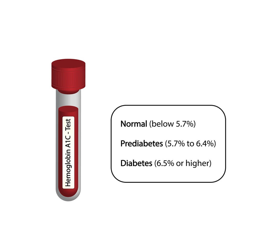 Test hemoglobina A1C učinkovit je način za praćenje kontrole šećera u krvi