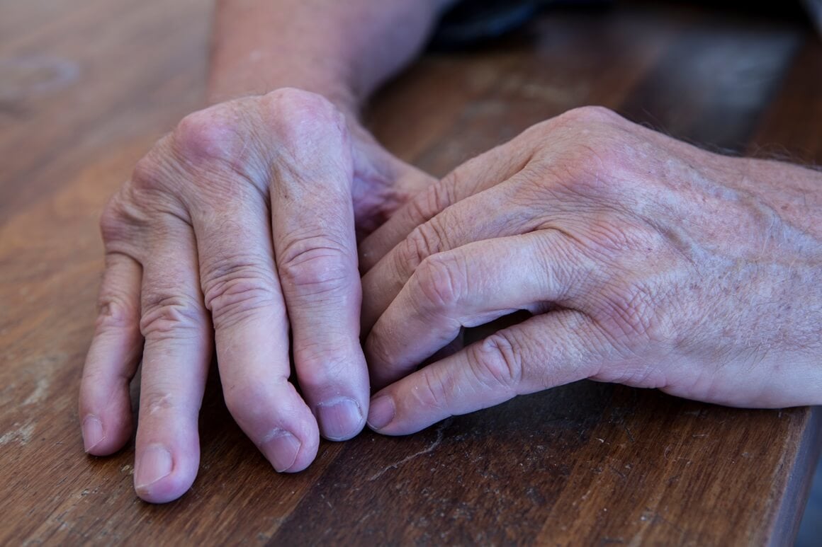 pojednostavite kuhanje i čišćenje kod psorijatičnog artritisa