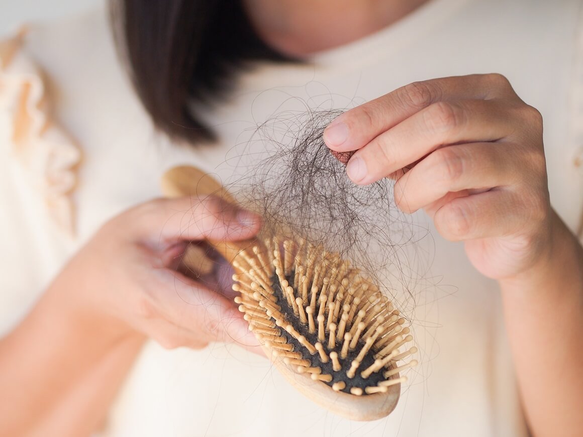 Alopecia areata nastaje kada imunološki sustav napada folikule kose