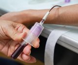 Ovaj test bolje otkriva rizik od bolesti srca od kolesterola