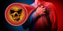 utjecaj SARS-CoV-2 na koronarne arterije