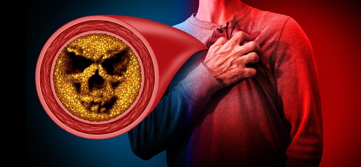 utjecaj SARS-CoV-2 na koronarne arterije