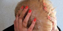 Osobe s dijabetesom tipa 1 često imaju i druge autoimune bolesti, poput alopecije areate