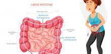 Simptomi IBS-a