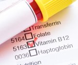 niske i visoke razine B12 mogu utjecati na kognitivnu funkciju