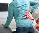 oštećenje bubrega može dovesti do kronične bolesti bubrega i zatajenja bubrega