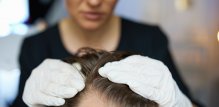 pregled kod dermatologa