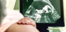 Majke imaju sklonost isticati sličnost djeteta s ocem