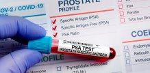 PSA probir može smanjiti rizik od smrti od raka prostate za 20 %