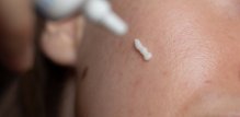 Tretinoin krema