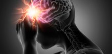 brain zaps