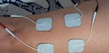 elektrostimulatori mišića
