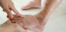 visoki šećer u krvi može oštetiti krvne žile, što utječe na sposobnost bubrega da regulira ravnotežu tekućina u tijelu