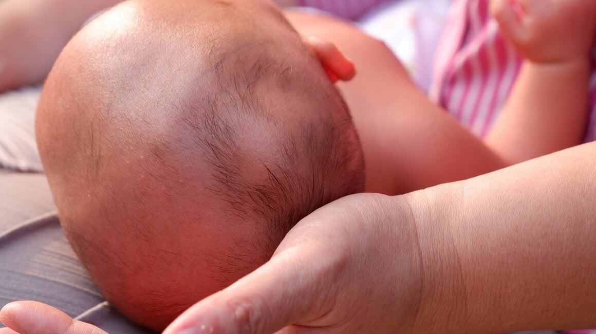 Hematom na glavi bebe nakon poroda