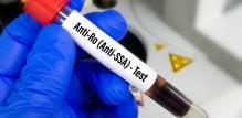 Kod autoimunih bolesti poput lupusa imunološki sustav može proizvesti antitijela (autoantitijela) koja napadaju stanice vlastitog tijela