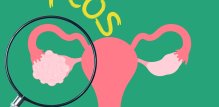 PCOS povećava rizik od raka endometrija